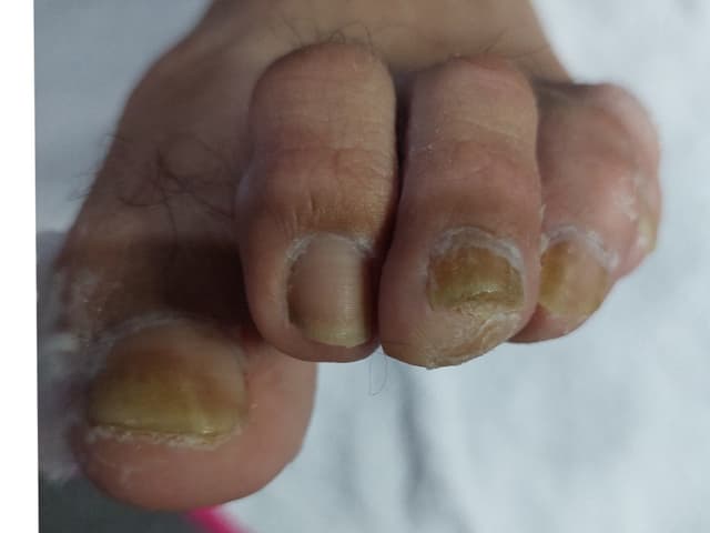 Pedicuria